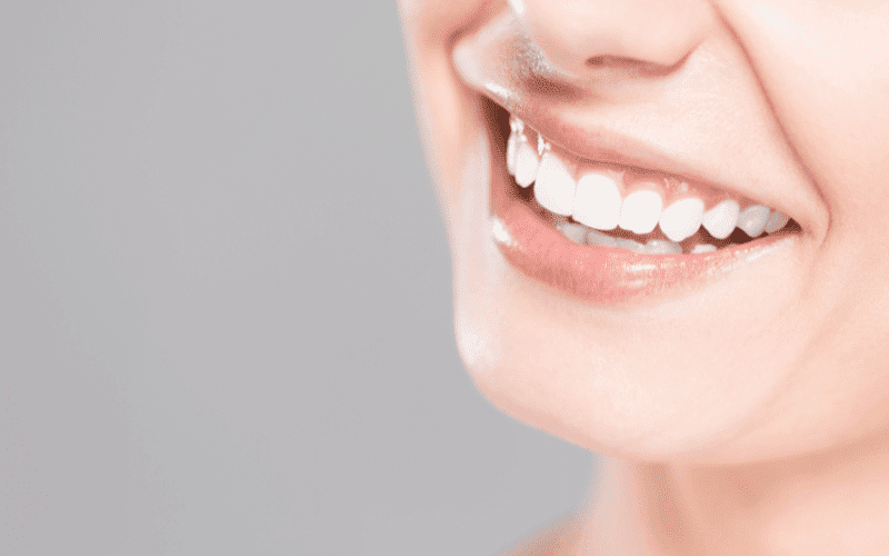 Natural Vs. Professional Teeth Whitening